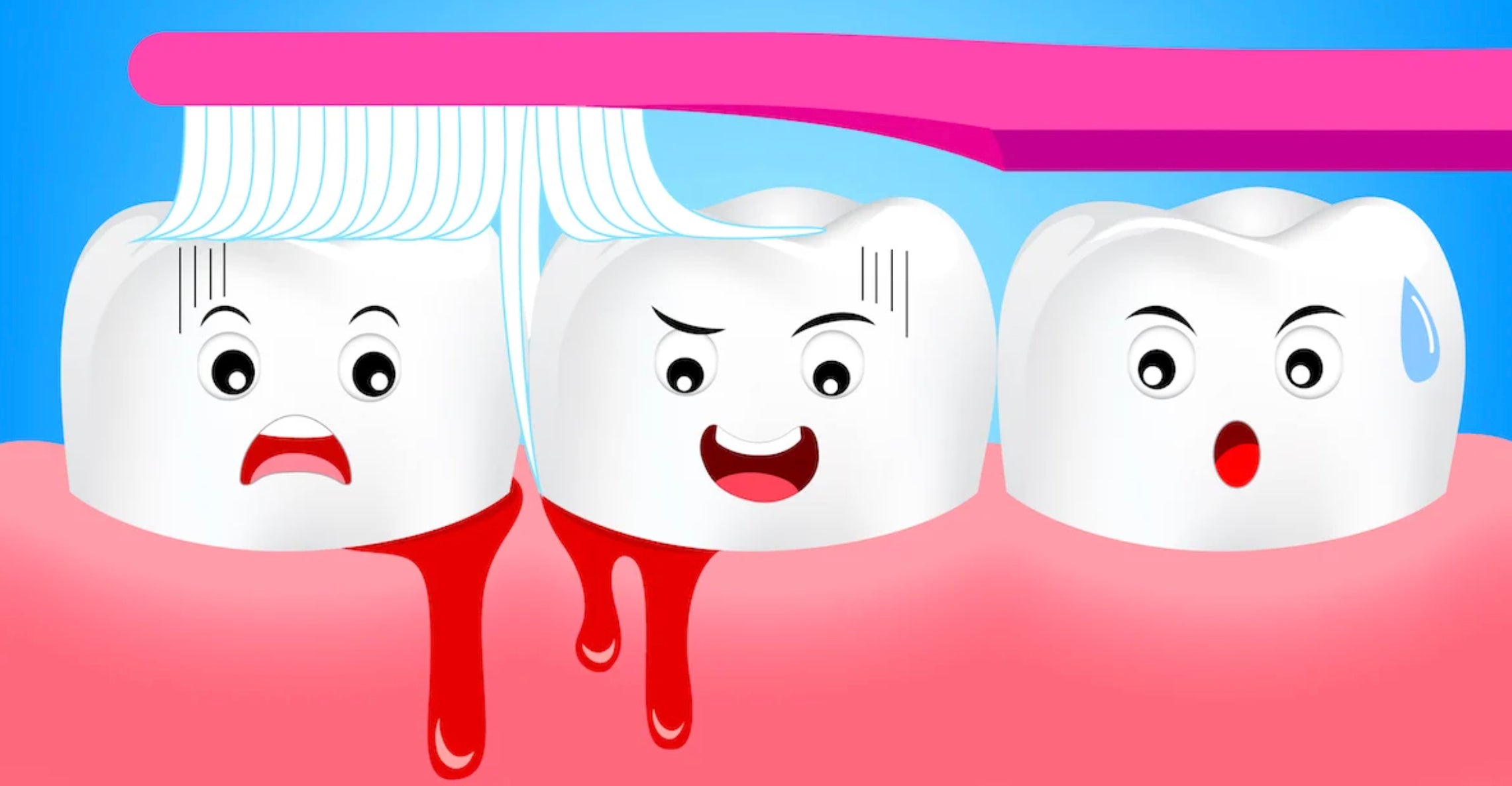 Why Are My Gums Bleeding